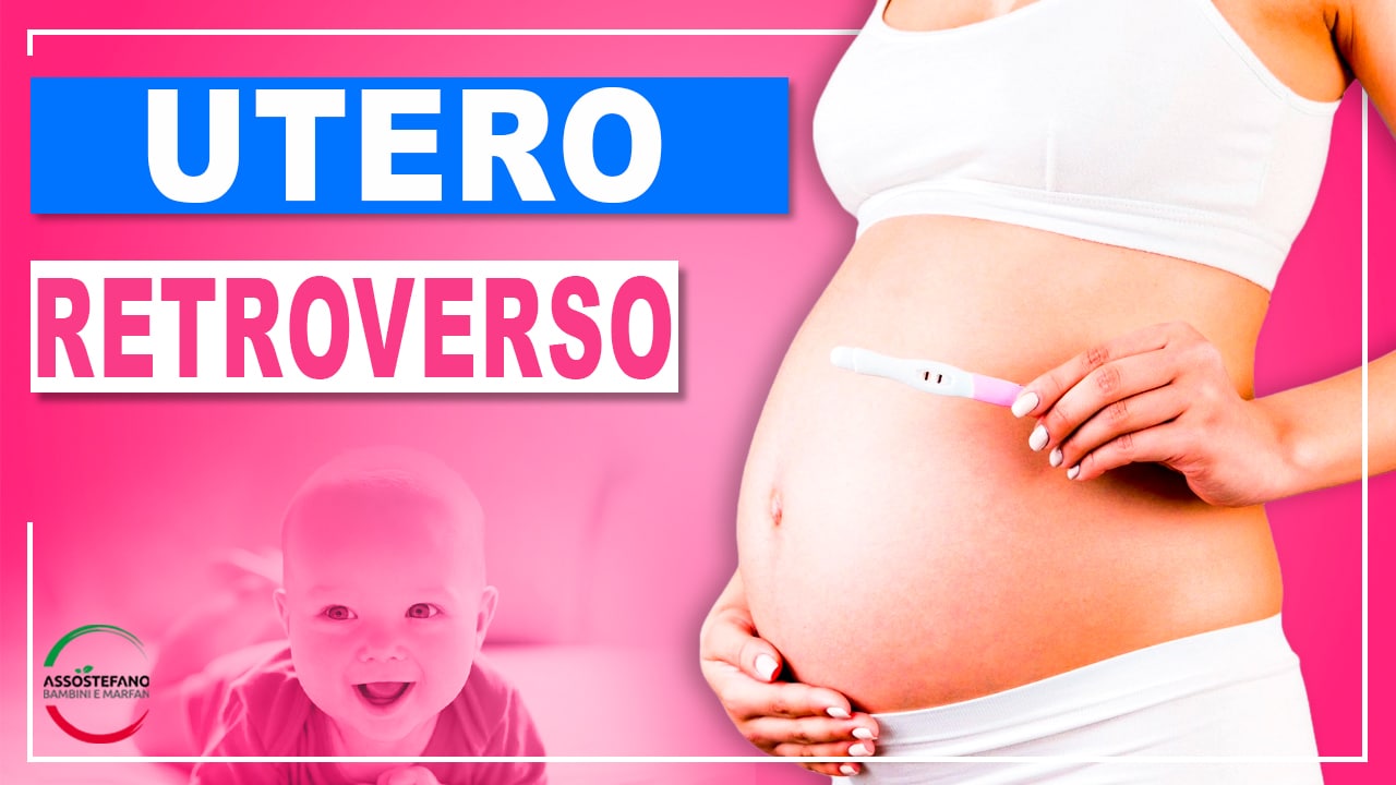 Utero Retroverso Sintomi