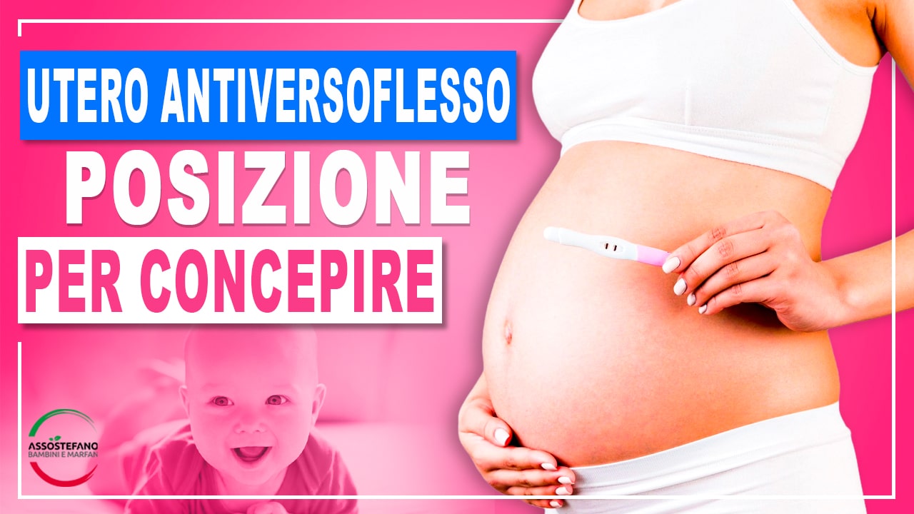 utero antiversoflesso posizione per concepire